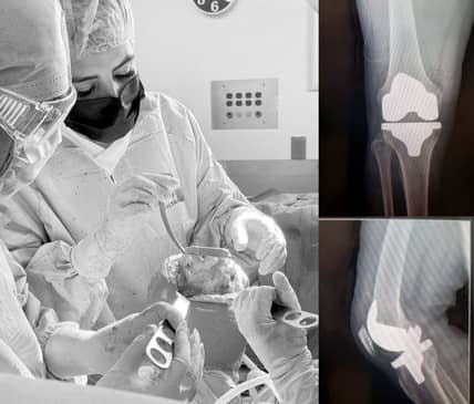 Slider image (4) Dr. Metztli Linette Gomez Espinoza - Orthopedic Clinic